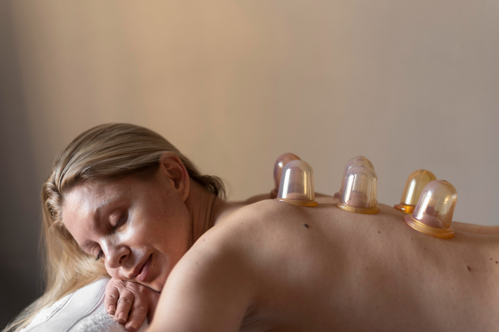 cupping massage